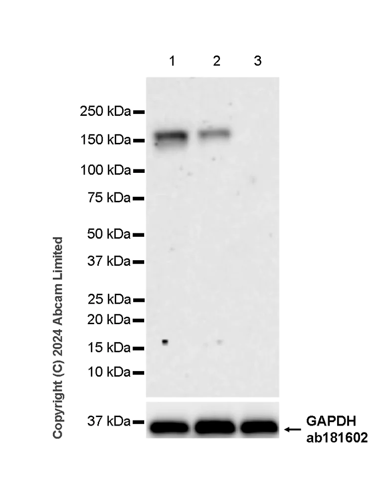 Western blot - Anti-nNOS (neuronal) antibody [RM1237] (AB323183)