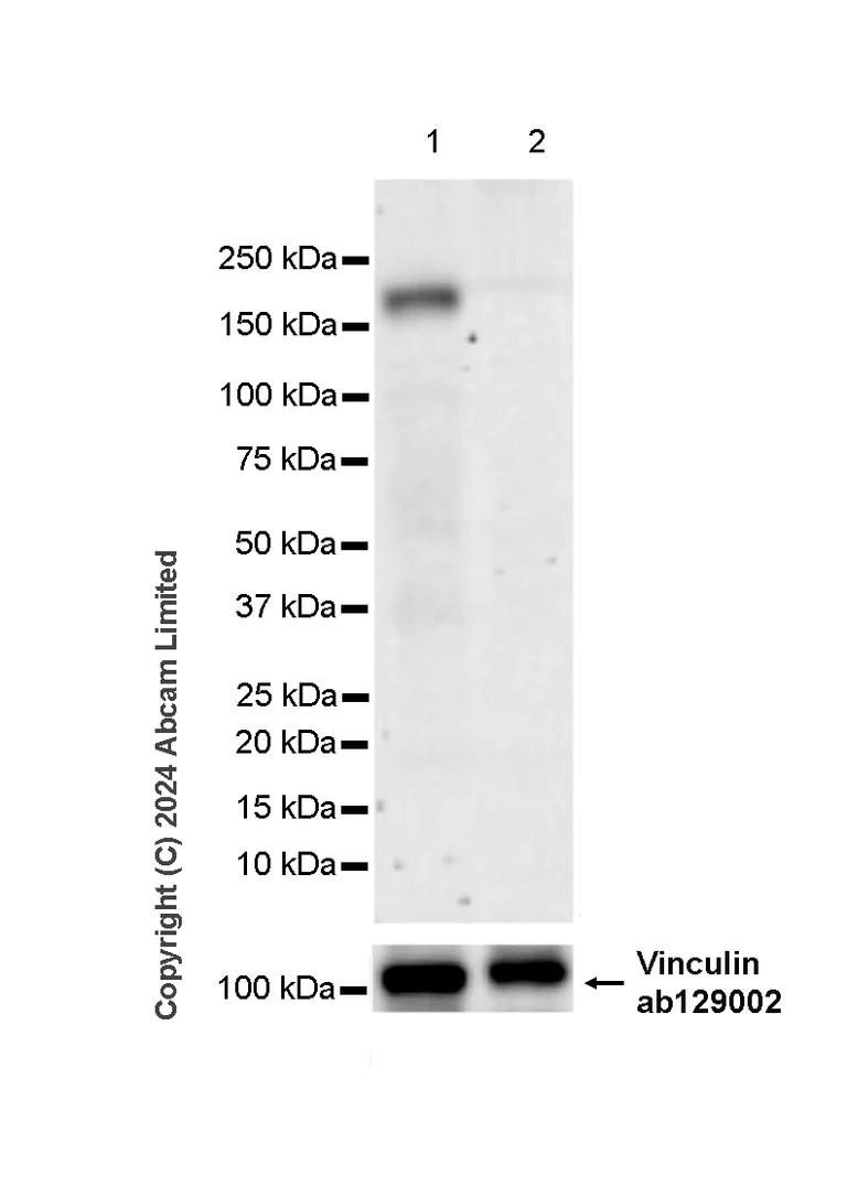 Western blot - Anti-nNOS (neuronal) antibody [RM1237] (AB323183)