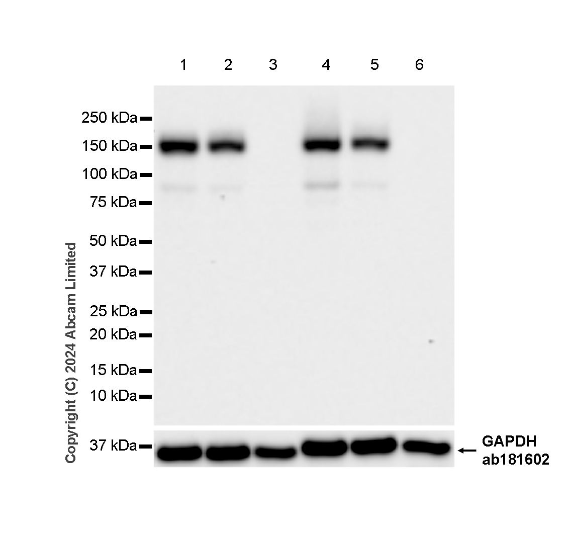 Western blot - Anti-nNOS (neuronal) antibody [RM1237] (ab323183), expandable thumbnail