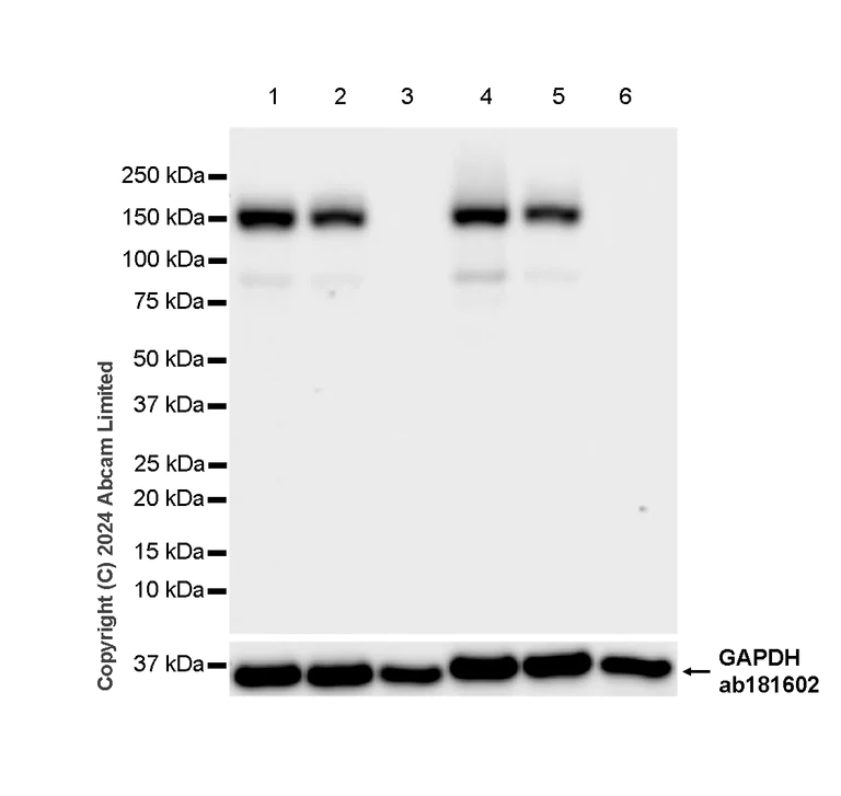 Western blot - Anti-nNOS (neuronal) antibody [RM1237] (AB323183)