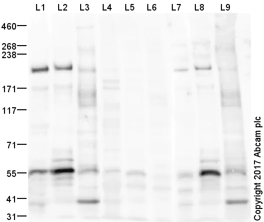 Western blot - Anti-nNOS (neuronal) (phospho S847) antibody (AB16650)