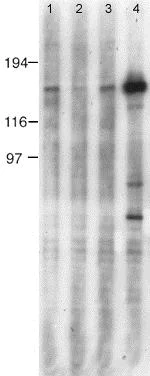 Western blot - Anti-nNOS (neuronal) (phospho S847) antibody (AB16650)