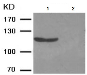 Western blot - Anti-nNOS (neuronal) (phospho S852) antibody (AB194524), expandable thumbnail