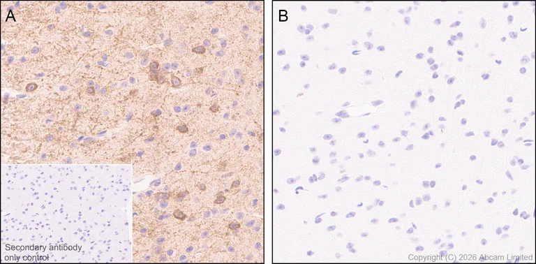Immunohistochemistry (Formalin/PFA-fixed paraffin-embedded sections) - Anti-nNOS (phospho S847) antibody [EPR28208-546] (AB325748)