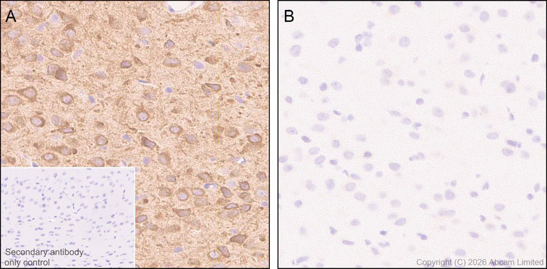 Immunohistochemistry (Formalin/PFA-fixed paraffin-embedded sections) - Anti-nNOS (phospho S847) antibody [EPR28208-546] (AB325748)