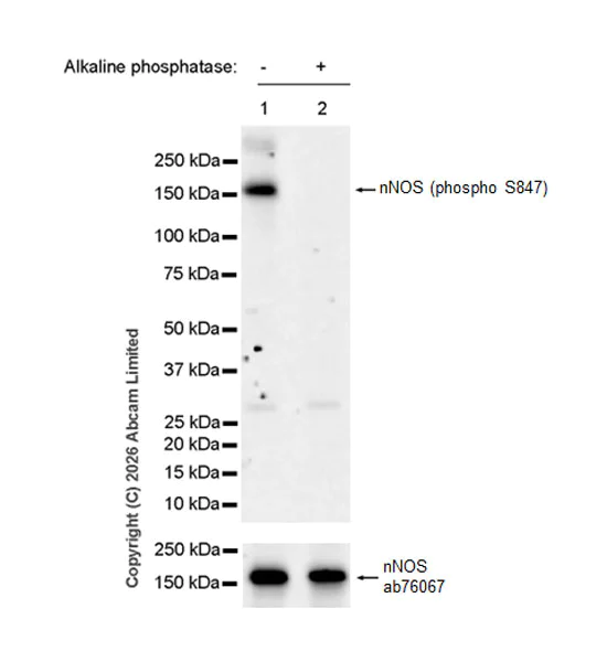 Western blot - Anti-nNOS (phospho S847) antibody [EPR28208-546] (AB325748)