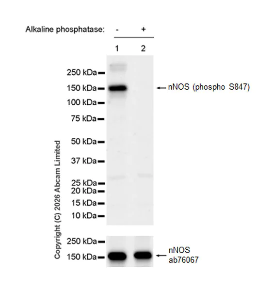 Western blot - Anti-nNOS (phospho S847) antibody [EPR28208-546] (AB325748)