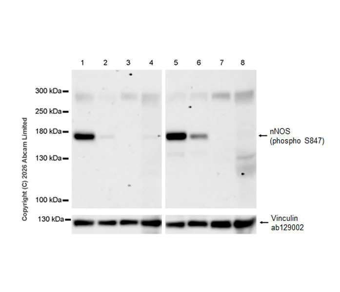 Western blot - Anti-nNOS (phospho S847) antibody [EPR28208-546] (AB325748)