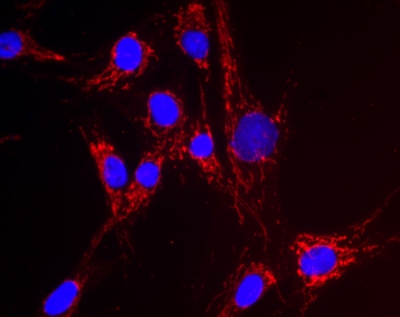 Immunocytochemistry/ Immunofluorescence - Anti-NNT antibody [8B4BB10] (AB110352), expandable thumbnail