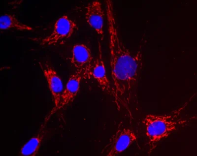 Immunocytochemistry/ Immunofluorescence - Anti-NNT antibody [8B4BB10] (AB110352)