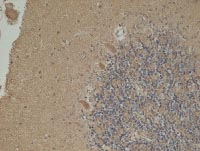 Immunohistochemistry (Formalin/PFA-fixed paraffin-embedded sections) - Anti-NNT antibody [8B4BB10] (AB110352), expandable thumbnail