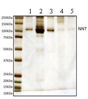 Immunoprecipitation - Anti-NNT antibody [8B4BB10] (AB110352), expandable thumbnail