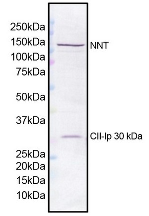 Western blot - Anti-NNT antibody [8B4BB10] (AB110352), expandable thumbnail