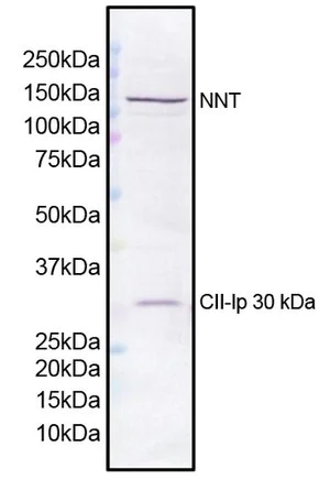 Western blot - Anti-NNT antibody [8B4BB10] (AB110352)
