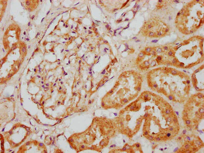 Immunohistochemistry (Formalin/PFA-fixed paraffin-embedded sections) - Anti-NNT1 antibody (AB238853)