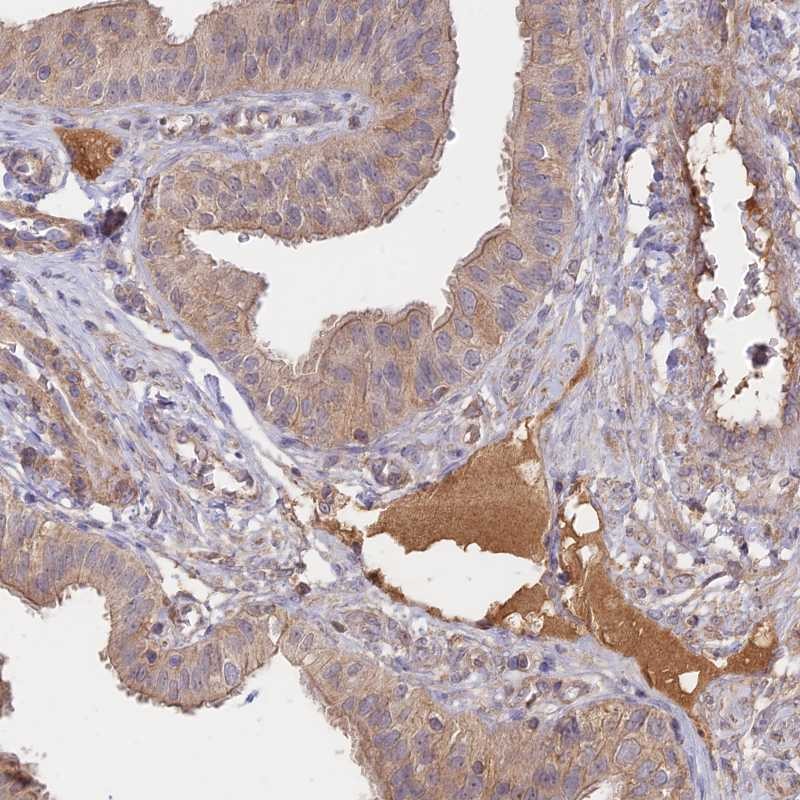 Immunohistochemistry (Formalin/PFA-fixed paraffin-embedded sections) - Anti-NNT1 antibody (AB251886)