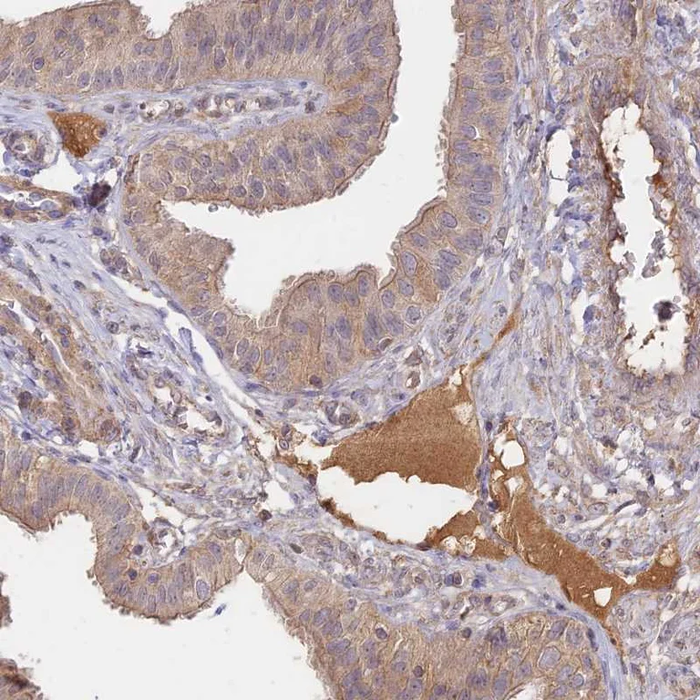 Immunohistochemistry (Formalin/PFA-fixed paraffin-embedded sections) - Anti-NNT1 antibody (AB251886)