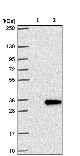 Western blot - Anti-NNT1 antibody (AB251886)