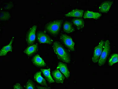 Immunocytochemistry/ Immunofluorescence - Anti-NOB1 antibody (AB224619)
