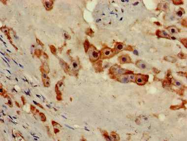 Immunohistochemistry (Formalin/PFA-fixed paraffin-embedded sections) - Anti-NOB1 antibody (AB224619)