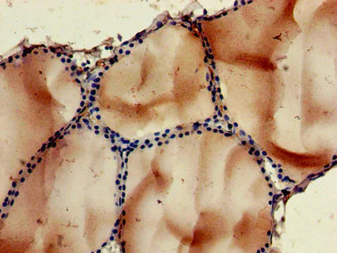 Immunohistochemistry (Formalin/PFA-fixed paraffin-embedded sections) - Anti-NOB1 antibody (AB224619)