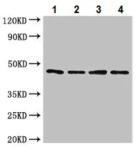 Western blot - Anti-NOB1 antibody (AB224619)