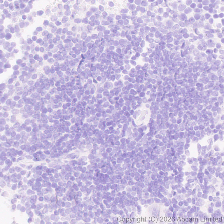 Immunohistochemistry (Formalin/PFA-fixed paraffin-embedded sections) - Anti-NOBOX antibody [EPR31141-550] (AB326941)