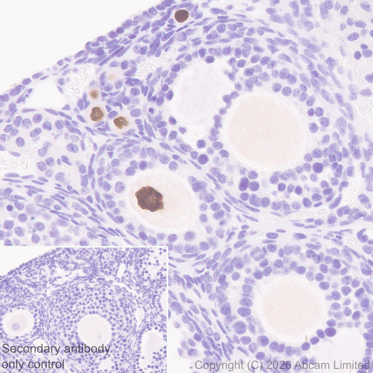 Immunohistochemistry (Formalin/PFA-fixed paraffin-embedded sections) - Anti-NOBOX antibody [EPR31141-550] - BSA and Azide free (AB326946)