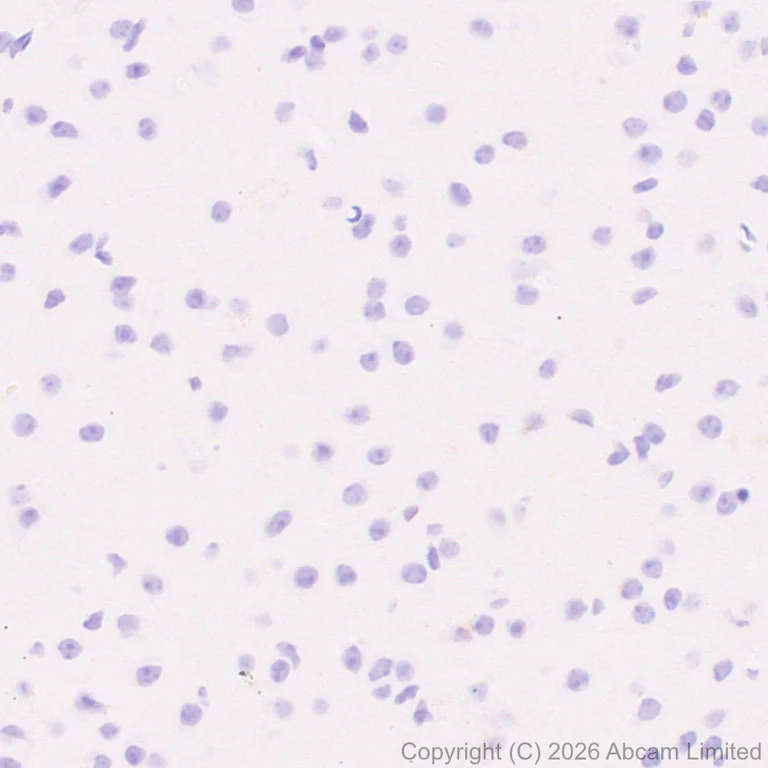 Immunohistochemistry (Formalin/PFA-fixed paraffin-embedded sections) - Anti-NOBOX antibody [EPR31141-550] - BSA and Azide free (AB326946)