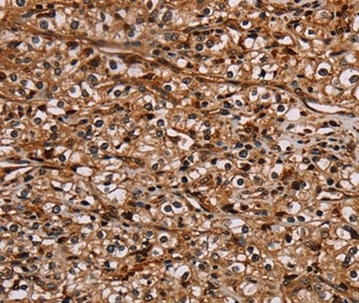 Immunohistochemistry (Formalin/PFA-fixed paraffin-embedded sections) - Anti-NOC2L antibody (AB198171)