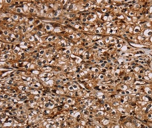 Immunohistochemistry (Formalin/PFA-fixed paraffin-embedded sections) - Anti-NOC2L antibody (AB198171)