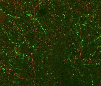 Immunohistochemistry (Formalin/PFA-fixed paraffin-embedded sections) - Anti-Nociceptin antibody (AB100880)