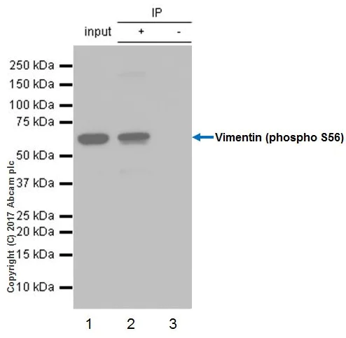 Immunoprecipitation - Nocodazole, Microtubule inhibitor (AB120630)