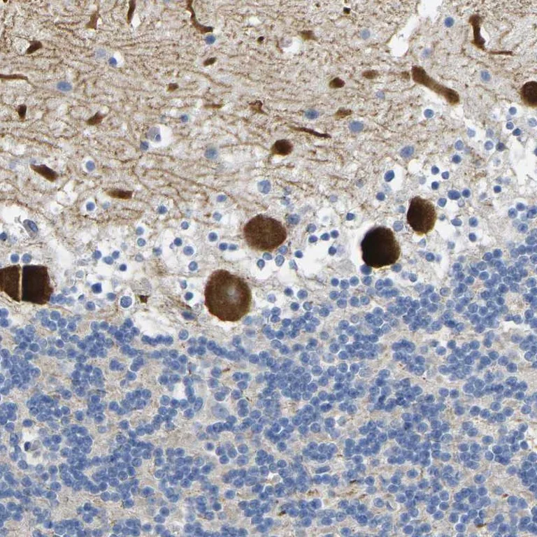 Immunohistochemistry (Formalin/PFA-fixed paraffin-embedded sections) - Anti-Nocturnin antibody (AB246904)