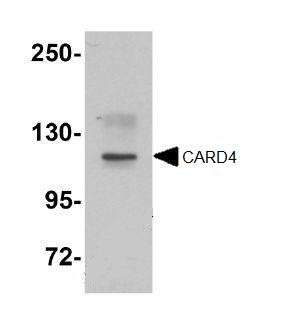 Western blot - Anti-NOD1 antibody (AB105338)