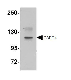 Western blot - Anti-NOD1 antibody (AB105338)