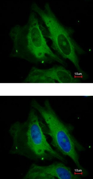 Immunocytochemistry/ Immunofluorescence - Anti-NOD1 antibody (AB189409)