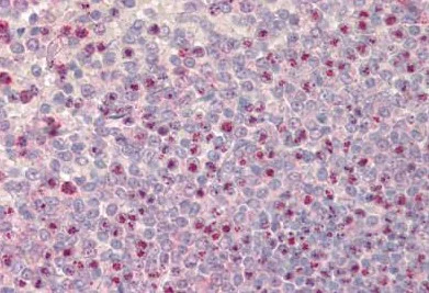 Immunohistochemistry (Formalin/PFA-fixed paraffin-embedded sections) - Anti-NOD1 antibody (AB189409)