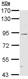 Western blot - Anti-NOD1 antibody (AB189409)