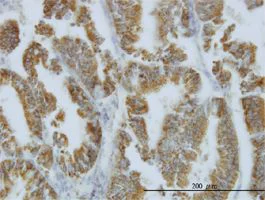 Immunohistochemistry (Formalin/PFA-fixed paraffin-embedded sections) - Anti-Nodal antibody [5C3] (AB55676)
