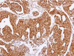 Immunohistochemistry (Formalin/PFA-fixed paraffin-embedded sections) - Anti-Noelin antibody - C-terminal (AB151416)
