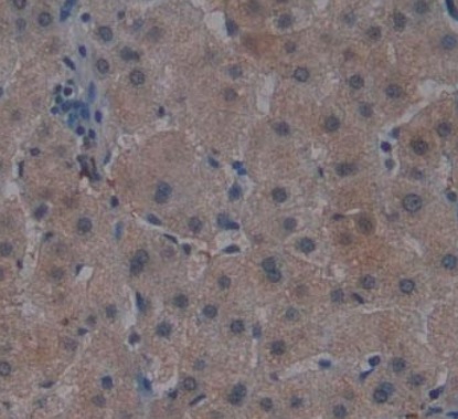 Immunohistochemistry (Formalin/PFA-fixed paraffin-embedded sections) - Anti-Noggin antibody [A11] (AB239520), expandable thumbnail