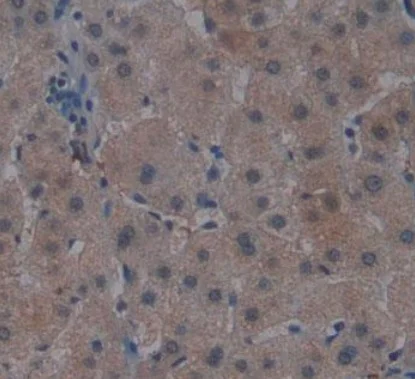 Immunohistochemistry (Formalin/PFA-fixed paraffin-embedded sections) - Anti-Noggin antibody [A11] (AB239520)