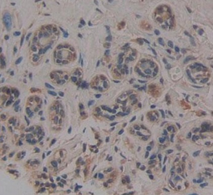 Immunohistochemistry (Formalin/PFA-fixed paraffin-embedded sections) - Anti-Noggin antibody [A11] (AB239520), expandable thumbnail