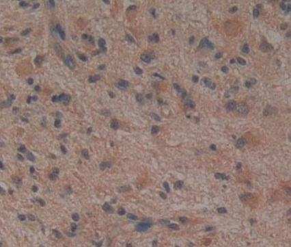 Immunohistochemistry (Formalin/PFA-fixed paraffin-embedded sections) - Anti-Noggin antibody [A11] (AB239520), expandable thumbnail