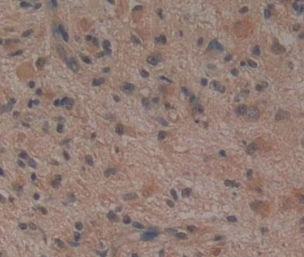 Immunohistochemistry (Formalin/PFA-fixed paraffin-embedded sections) - Anti-Noggin antibody [A11] (AB239520)