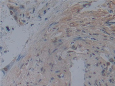 Immunohistochemistry (Formalin/PFA-fixed paraffin-embedded sections) - Anti-Noggin antibody [A11] (AB239520), expandable thumbnail