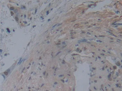 Immunohistochemistry (Formalin/PFA-fixed paraffin-embedded sections) - Anti-Noggin antibody [A11] (AB239520)