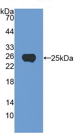Western blot - Anti-Noggin antibody [A11] (ab239520), expandable thumbnail