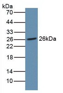 Western blot - Anti-Noggin antibody [A11] (AB239520), expandable thumbnail